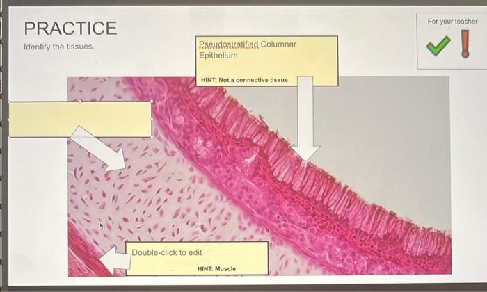 Solved PRACTICE Identify The Tissues. | Chegg.com