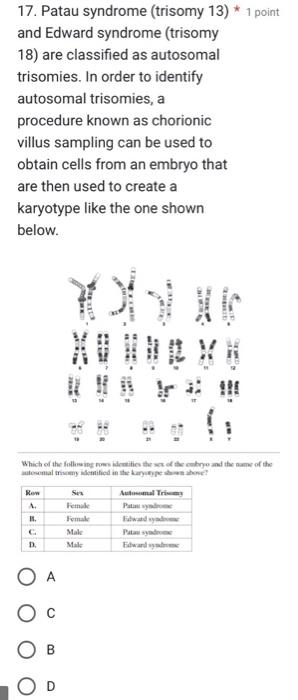 edward syndrome karyotype