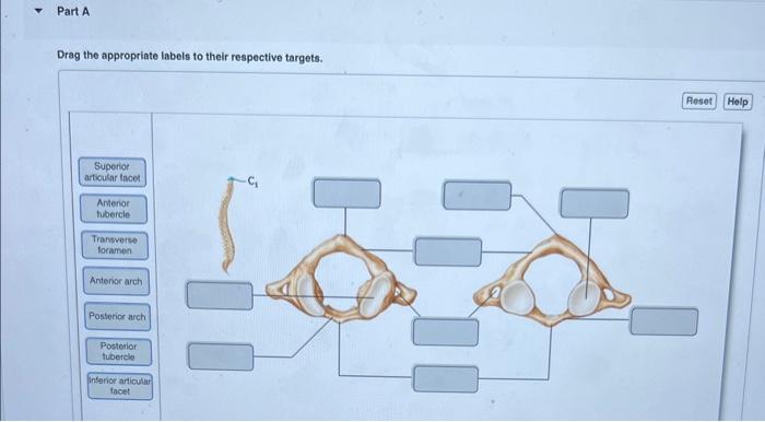 Solved Which part of a vertebra is known as the centrum? | Chegg.com