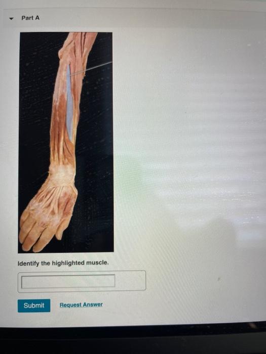 Solved Muscular System: Upper Limb > Lab Practical PAL: | Chegg.com