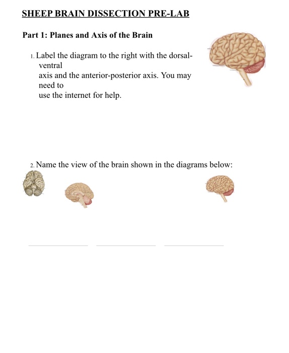 Solved SHEEP BRAIN DISSECTION PRELAB Part 1 Planes and
