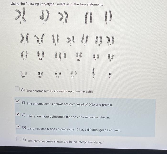 Solved Using the following karyotype, select all of the true | Chegg.com