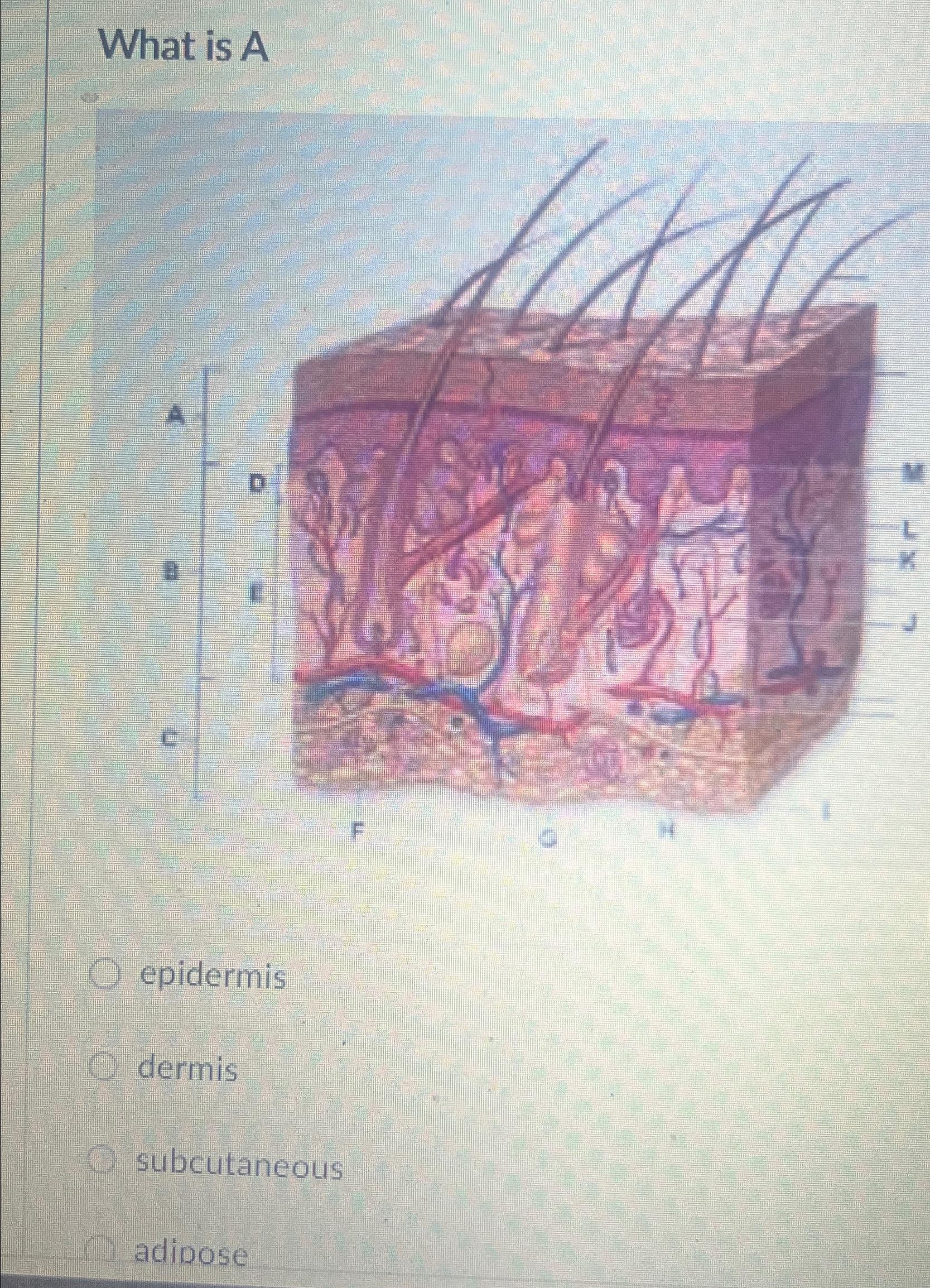 Solved What is Aepidermisdermissubcutaneousadipose | Chegg.com