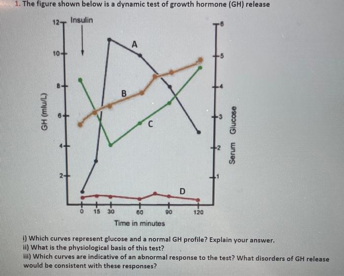 Solved 1. The figure shown below is a dynamic test of growth | Chegg.com