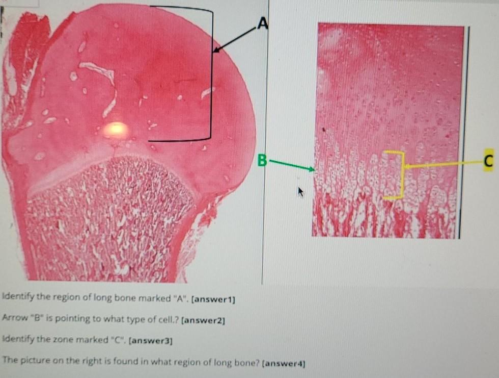 Solved с Identify the region of long bone marked "A". | Chegg.com
