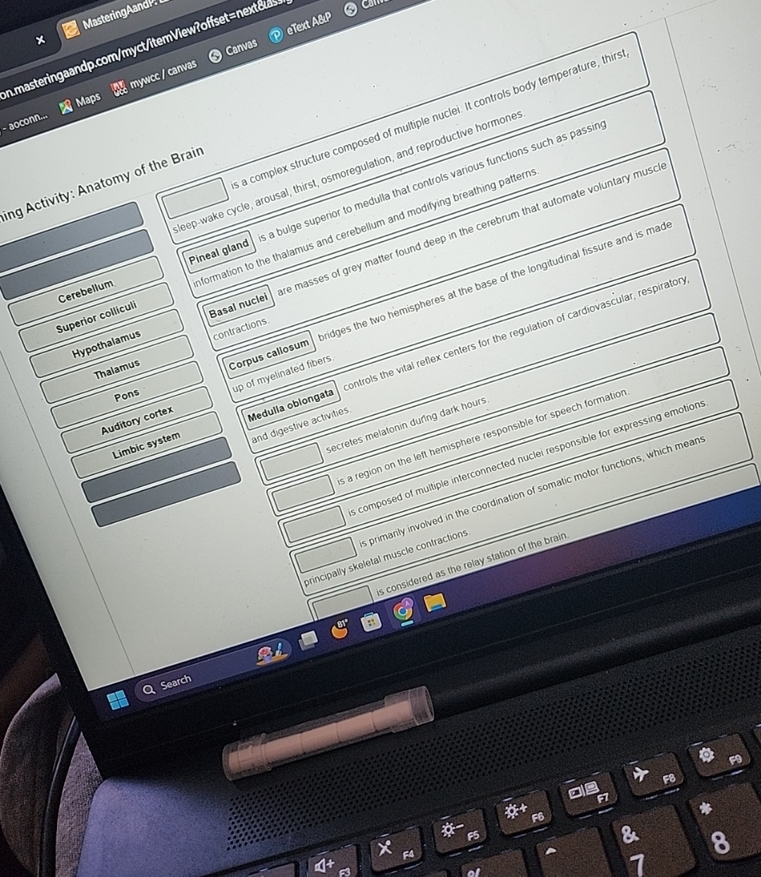 Solved activity Anatomy of the BrainCerebellumSuperior