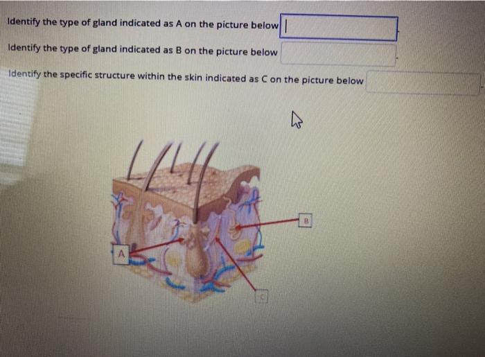 Solved QUESTION TUT Identify the layer of the skin indicates | Chegg.com