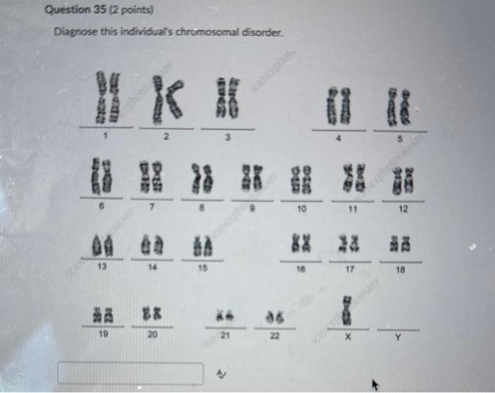 Solved Question 35 (2 points) Diagnose this individual's | Chegg.com