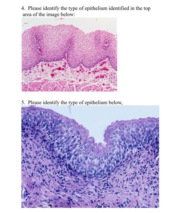 Solved 4. Please identify the type of epithelium identified | Chegg.com
