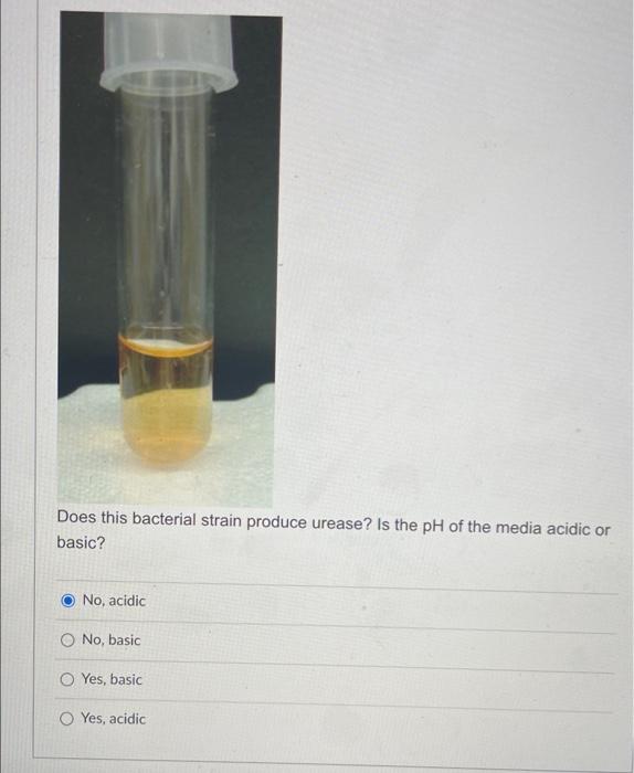 Solved Does this bacterial strain produce urease? Is the pH | Chegg.com