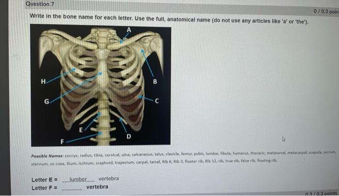Solved Write in the bone name for each letter. Use the full, | Chegg.com