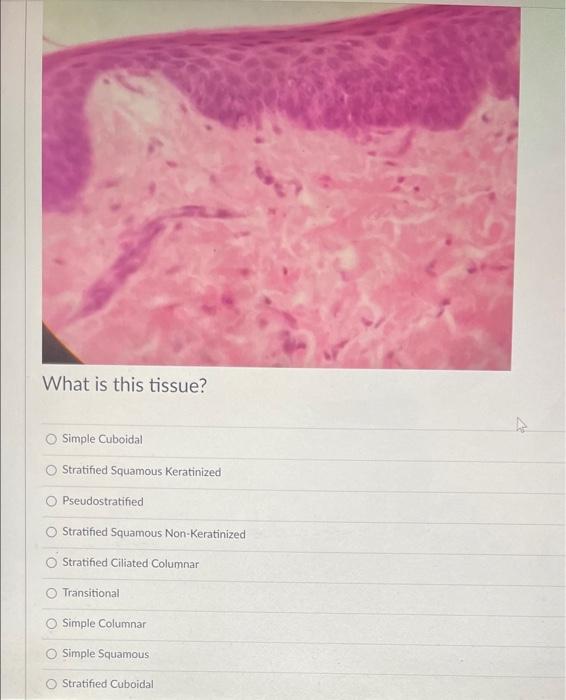 What is this tissue?
Simple Cuboidal
Stratified Squamous Keratinized
Pseudostratified
Stratified Squamous Non-Keratinized
Str