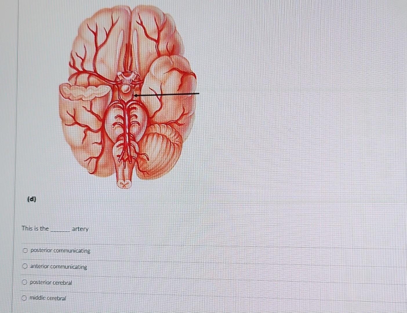 (d) This is the artery posterior communicating anterior communicatins posterior cerebral middle cerebral