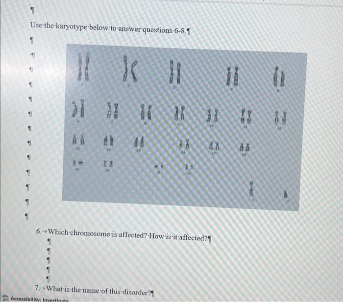 Solved 1 Use the karyotype below to answer questions 6-8.1 1 | Chegg.com