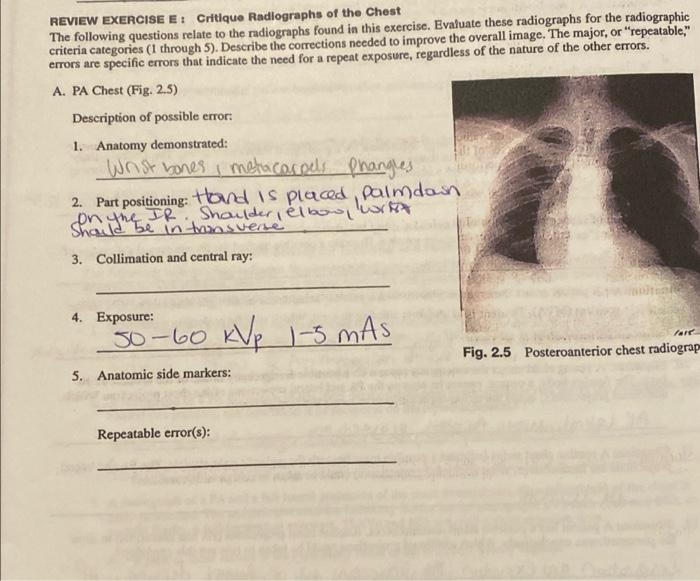 Solved REVIEW EXERCISE E Critique Radiographs of the Chest | Chegg.com