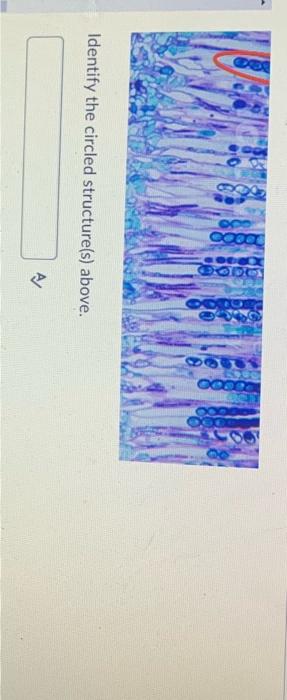 solved-identify-the-circled-structure-s-above-chegg