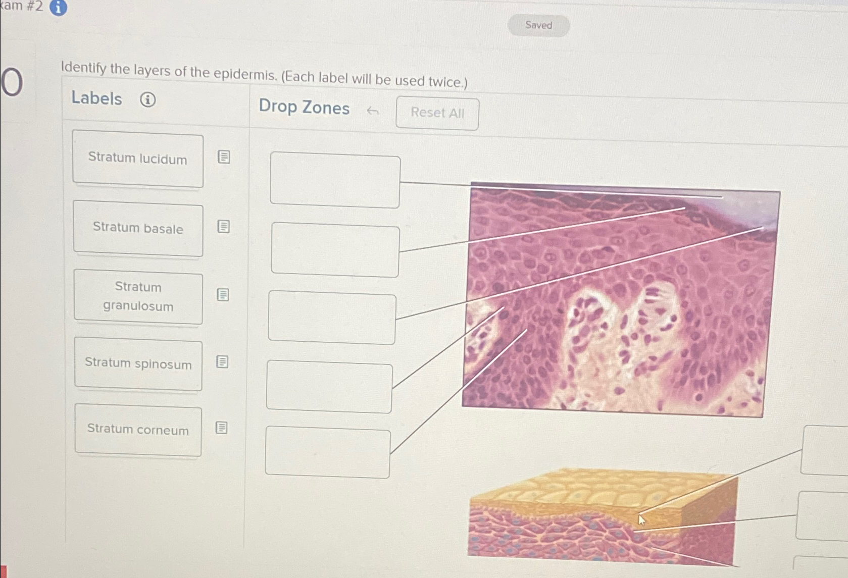 Solved Identify the layers of the epidermis. (Each label | Chegg.com