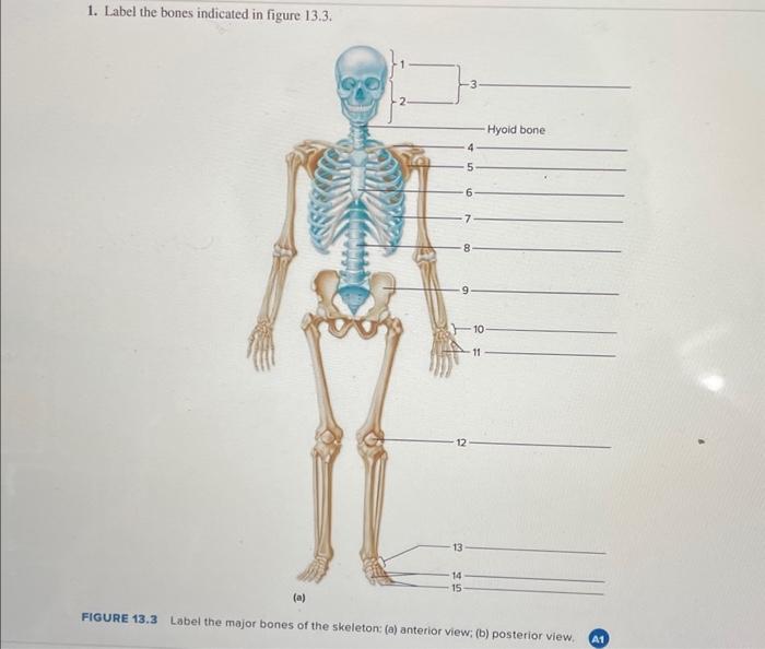 Solved 1 Label The Bones Indicated In Figure 133 Figure