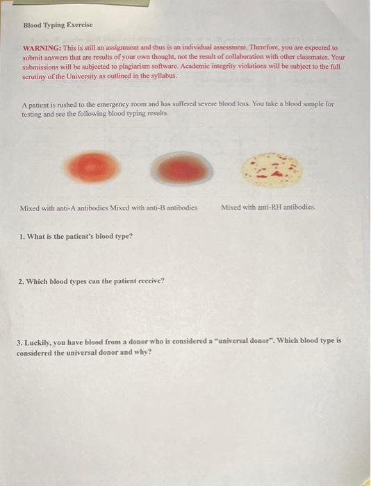 Solved Blood Typing Excreise WARNING: This is still an | Chegg.com