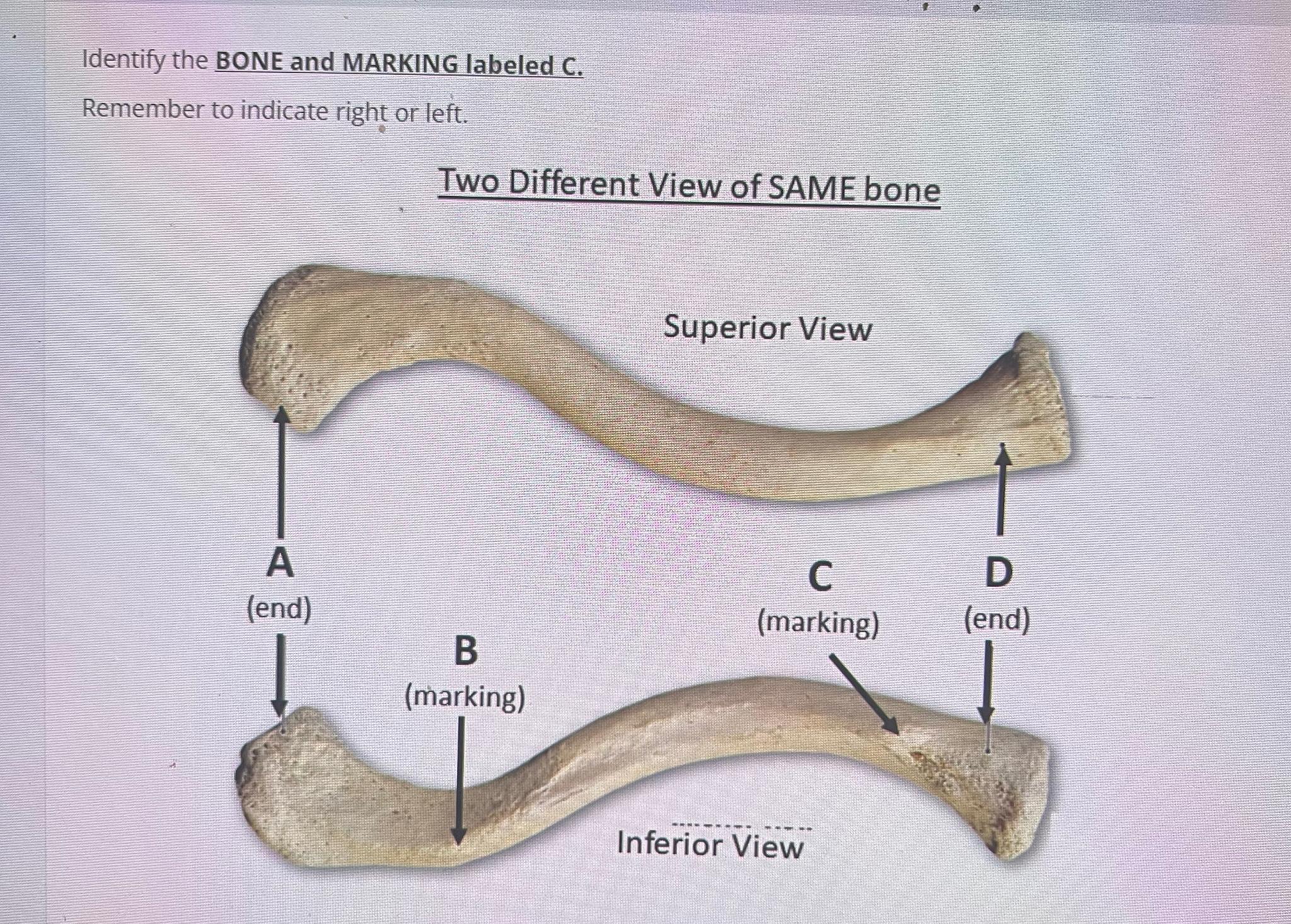 Solved Identify the BONE and MARKING labeled C.Remember to | Chegg.com