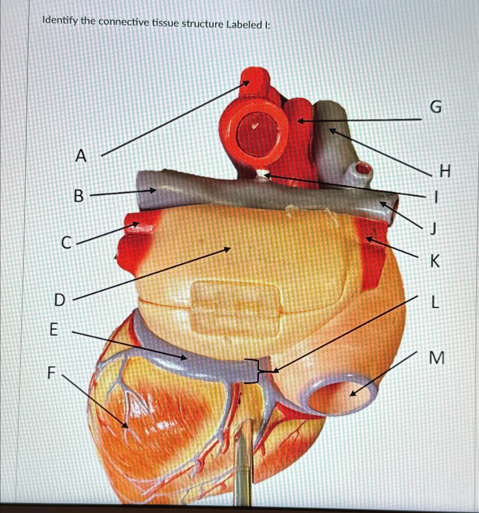 Solved Identify the connective tissue structure Labeled I: | Chegg.com