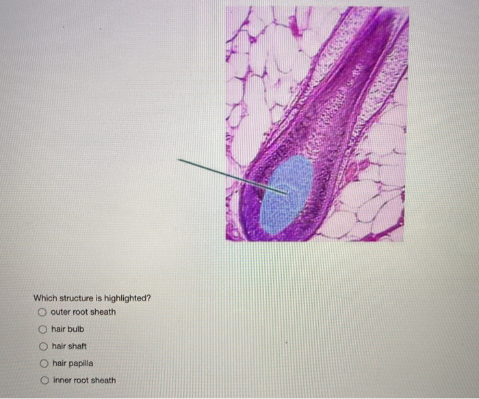 Solved Which structure is highlighted? O outer root sheath | Chegg.com