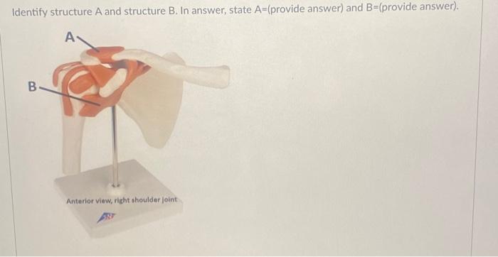 Solved Identify Structure A And Structure B. In Answer, | Chegg.com