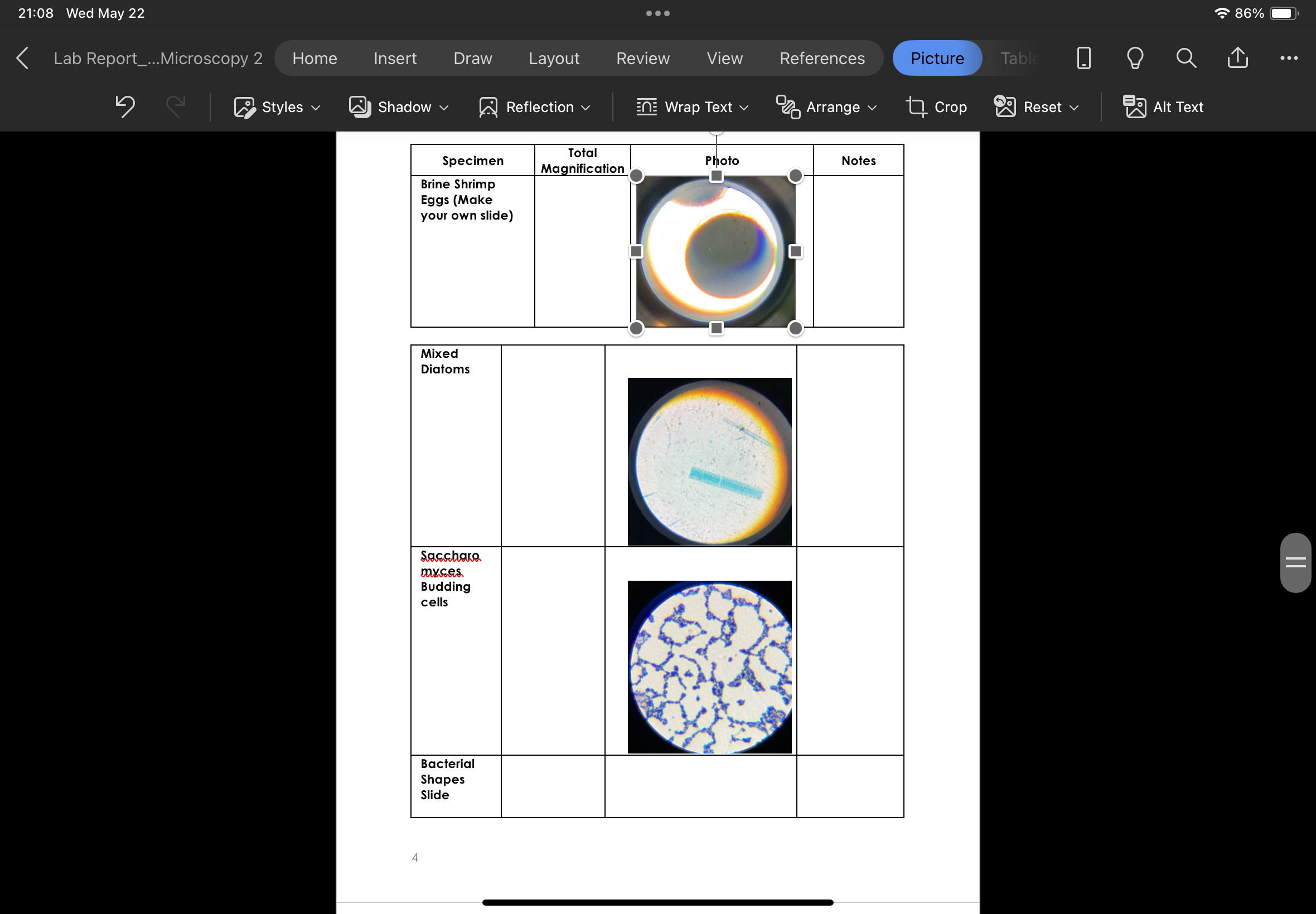 Solved Can you add notes on the specimens microscopic | Chegg.com