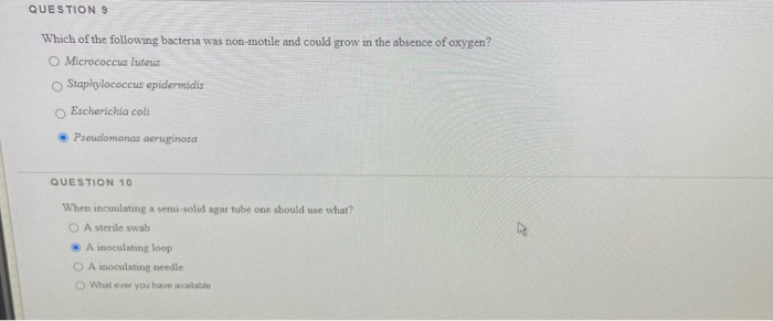 Solved Question 2 When Bacteria Grow Only On The Top Of The 