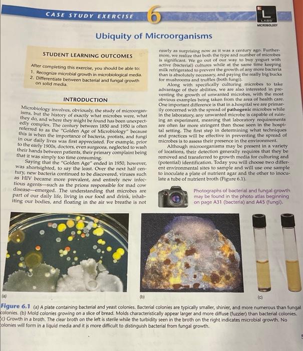 Understanding Liquid Growth Medium: A Key Tool in Microbial