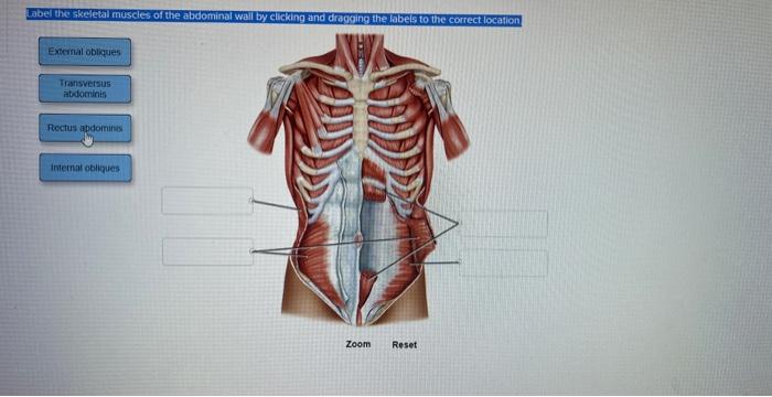 Solved Labe the axcletal muscles of the abdominal wall by | Chegg.com