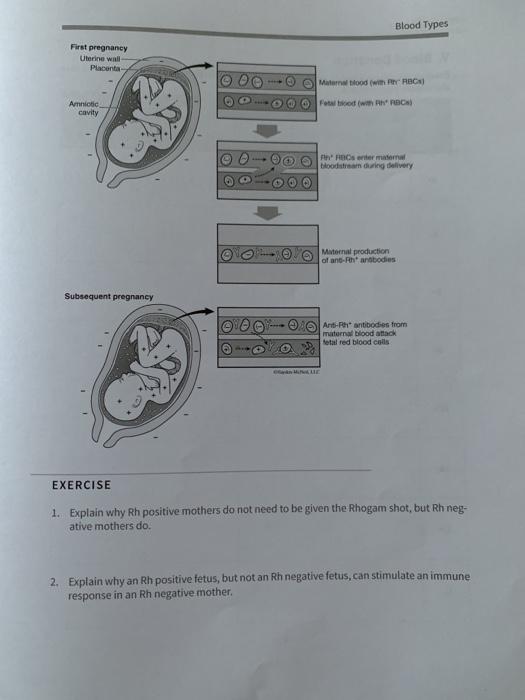 Blood Type A Rh D Positive And Pregnancy