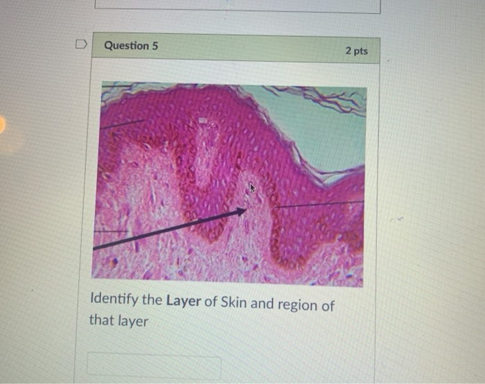 Solved Question 5 2 pts Identify the Layer of Skin and | Chegg.com