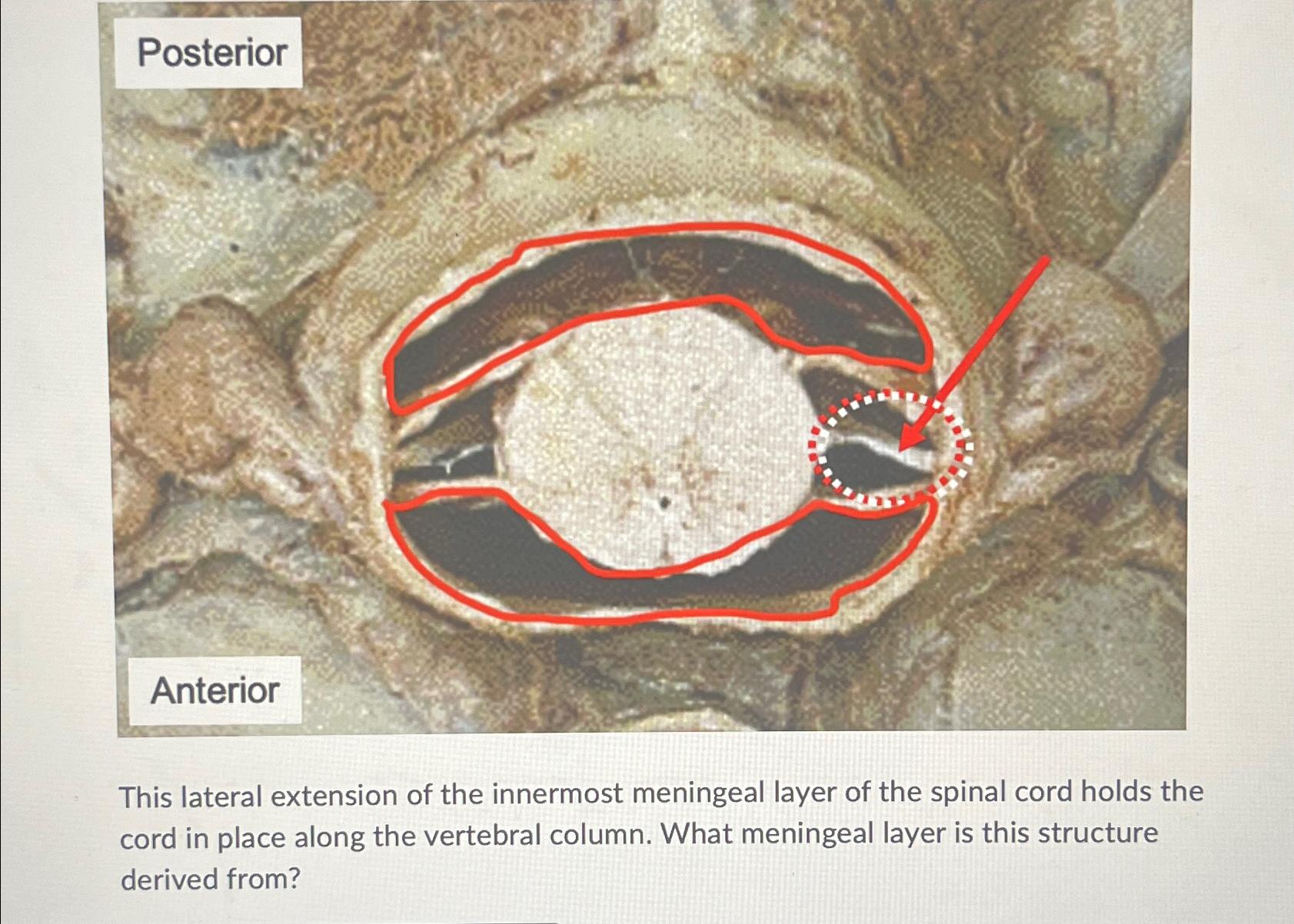 Solved PosteriorAnteriorThis lateral extension of the | Chegg.com