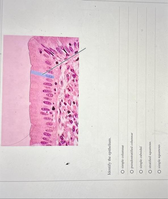 Solved Identify the epithelium. simple columnar | Chegg.com