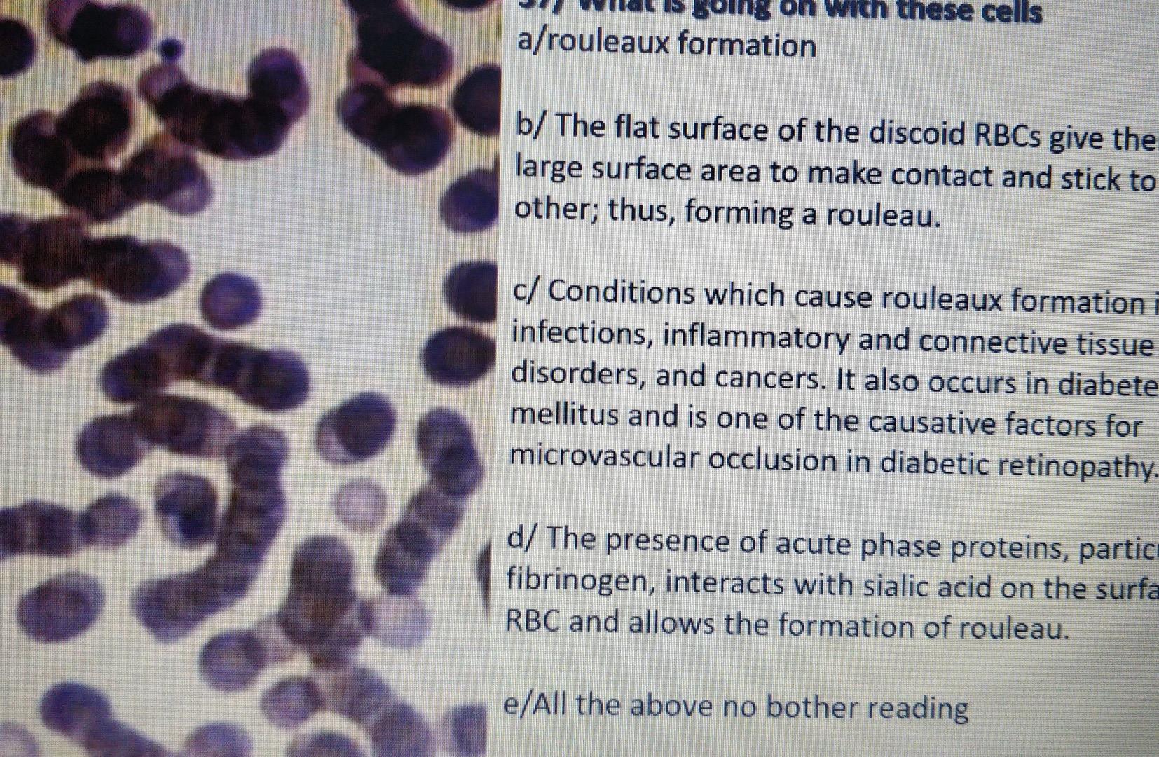 Solved on with these cells a/rouleaux formation b/ The flat
