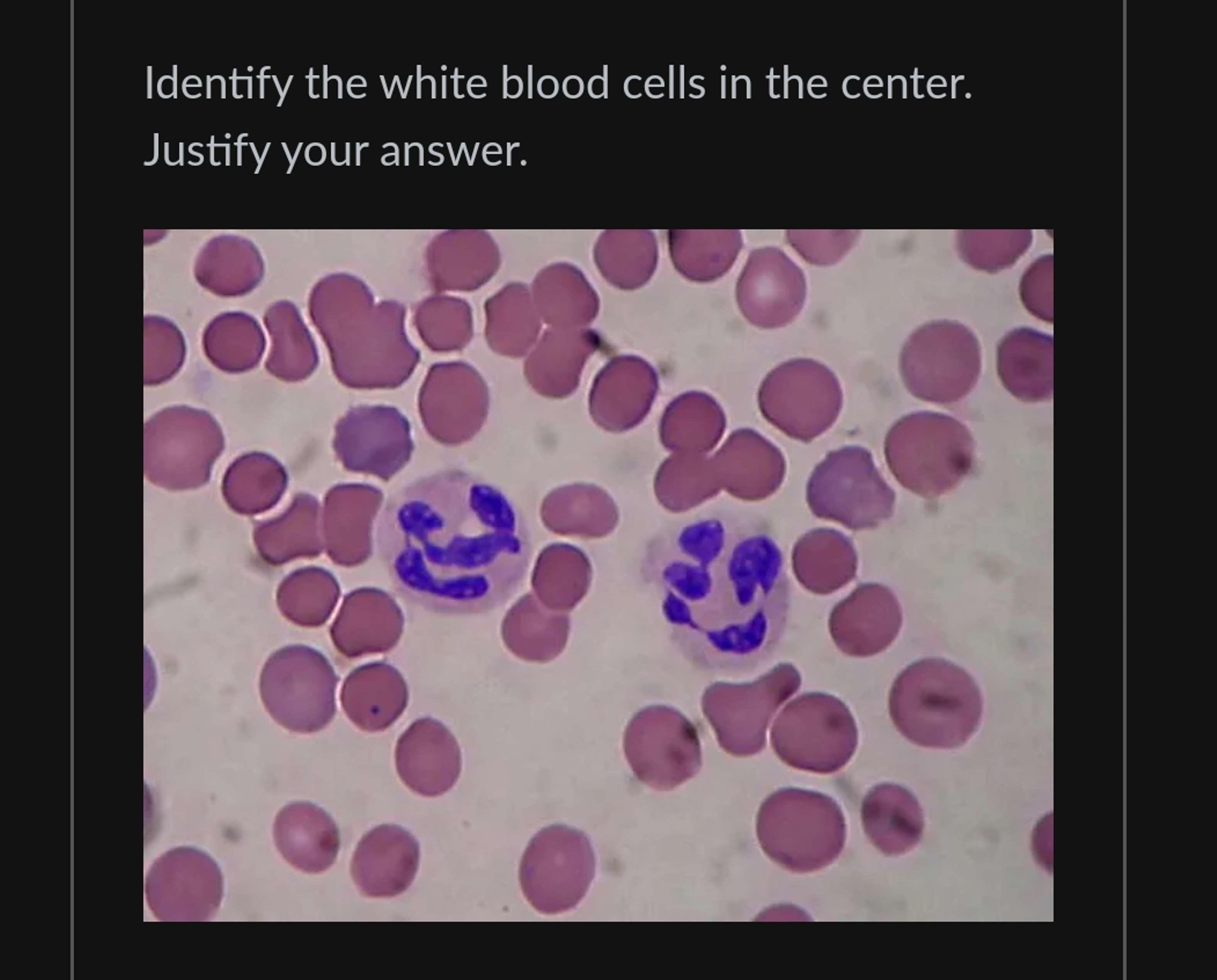 Solved Identify the white blood cells in the center. Justify | Chegg.com