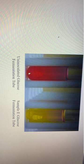 Solved Identifying Your Unknown Bacteria Step 1: Gram Stain | Chegg.com