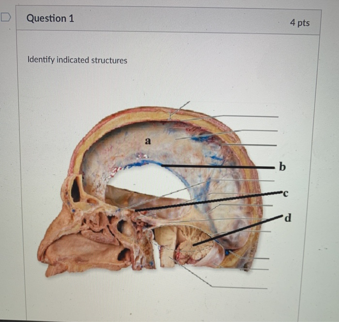 Solved Question 1 4 Pts Identify Indicated Structures а B °C | Chegg.com