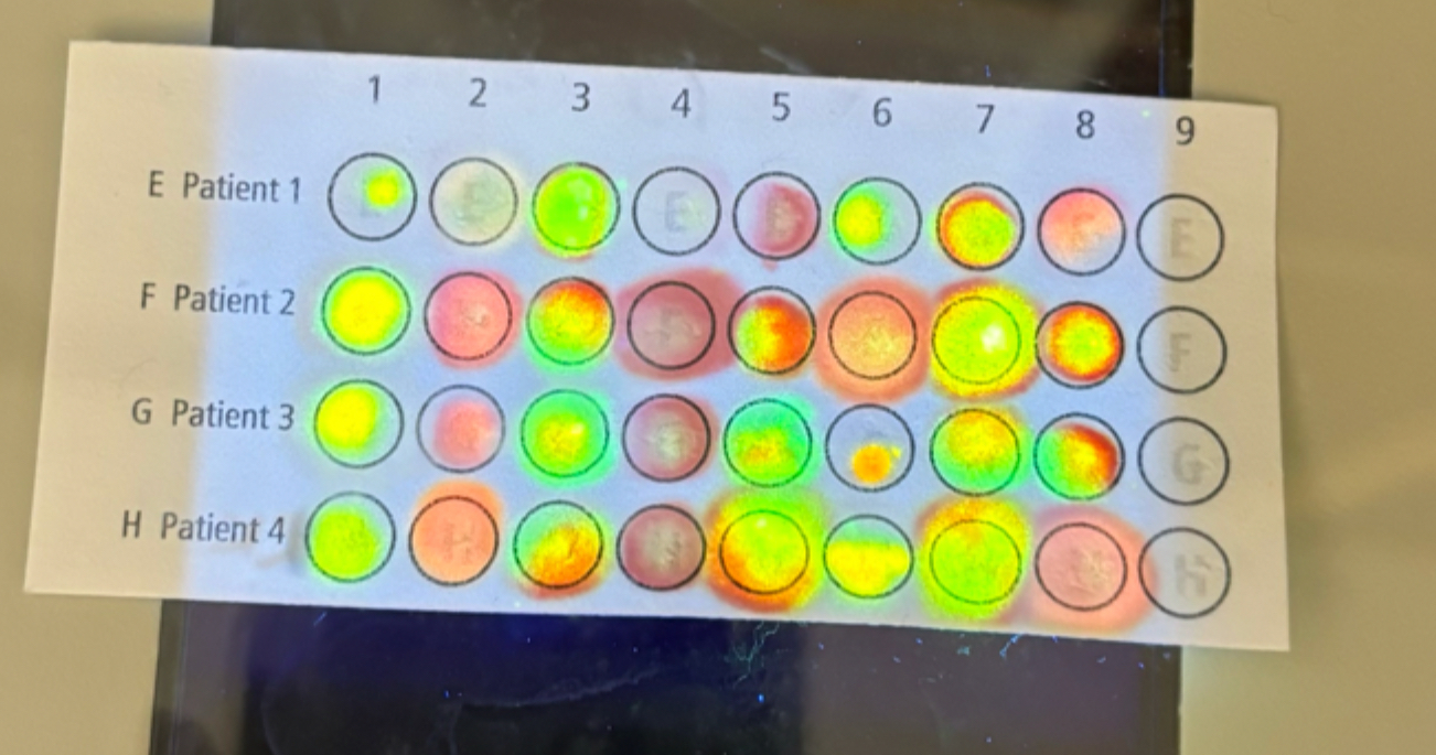 Solved 1Interpret the results of your microarray for patient | Chegg.com