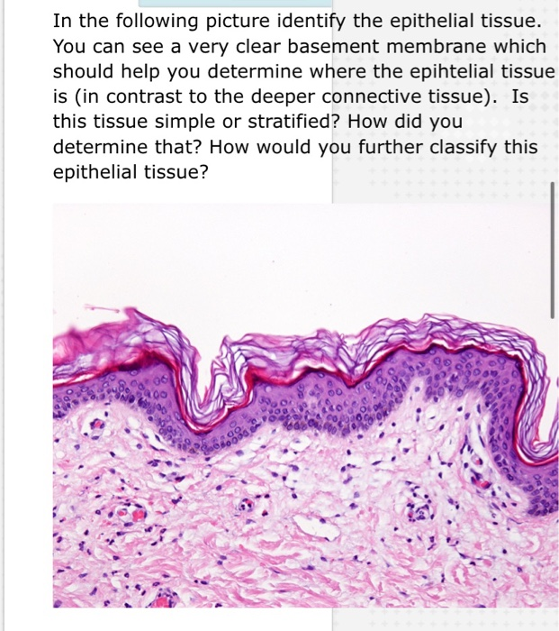 i-epithelial-tissue-cell-junction-basement-membrane-epithelial-tissue