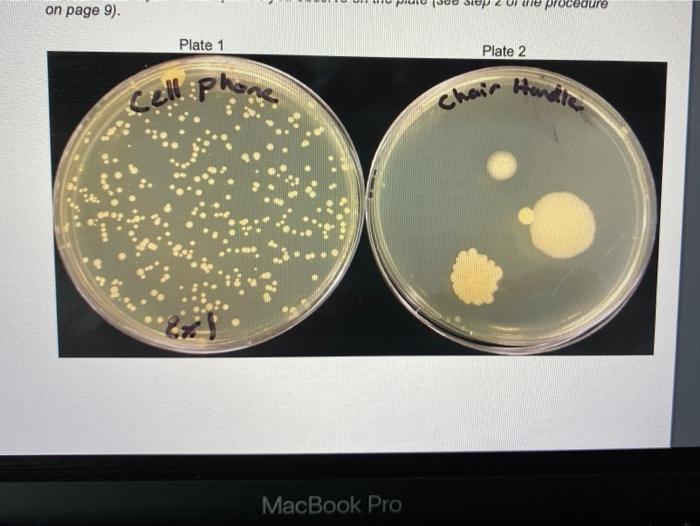 Solved Ex. 1 Microbial Ubiquity Part 1. Microbes Around US | Chegg.com