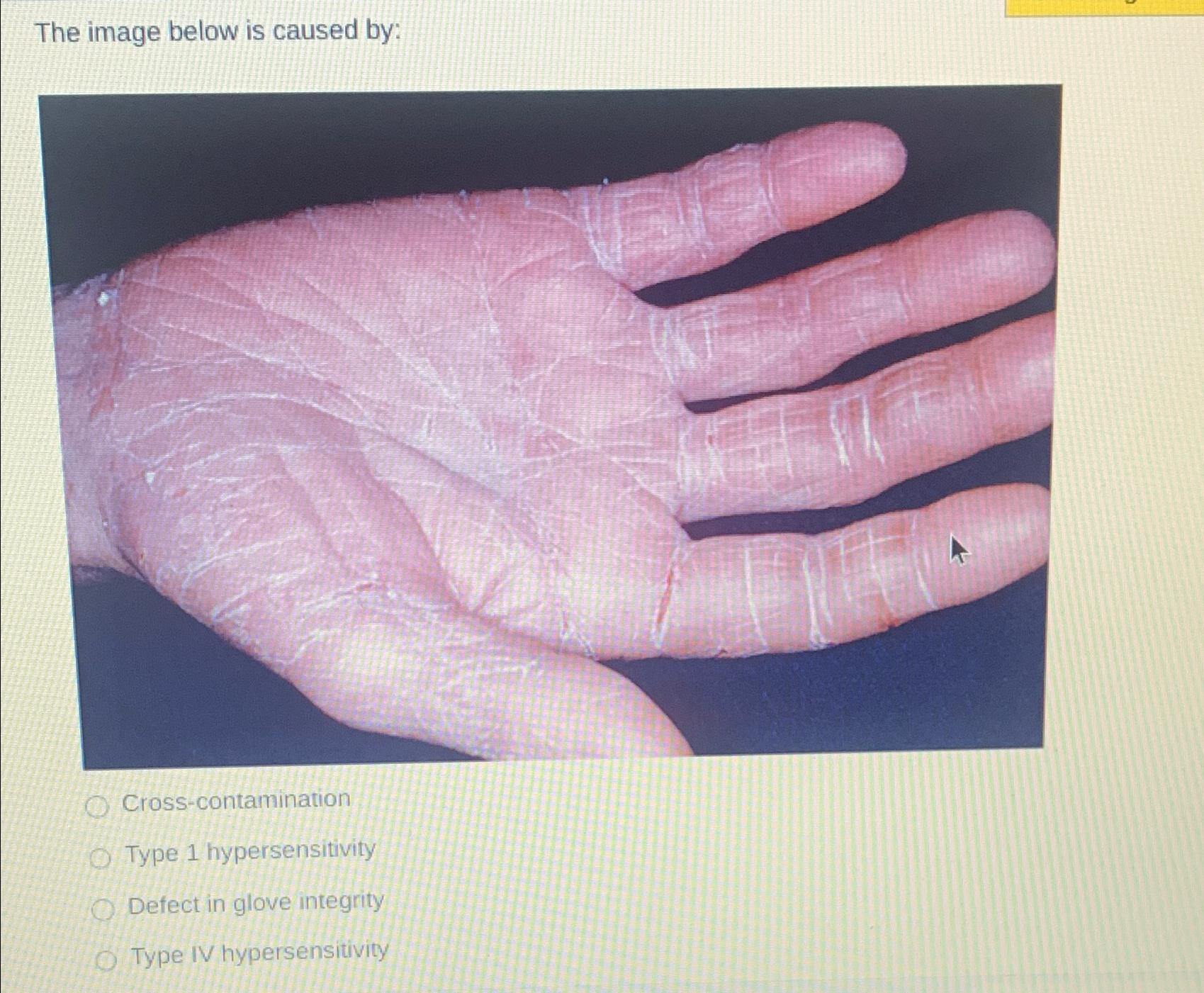 The image below is caused by:Cross-contaminationType | Chegg.com