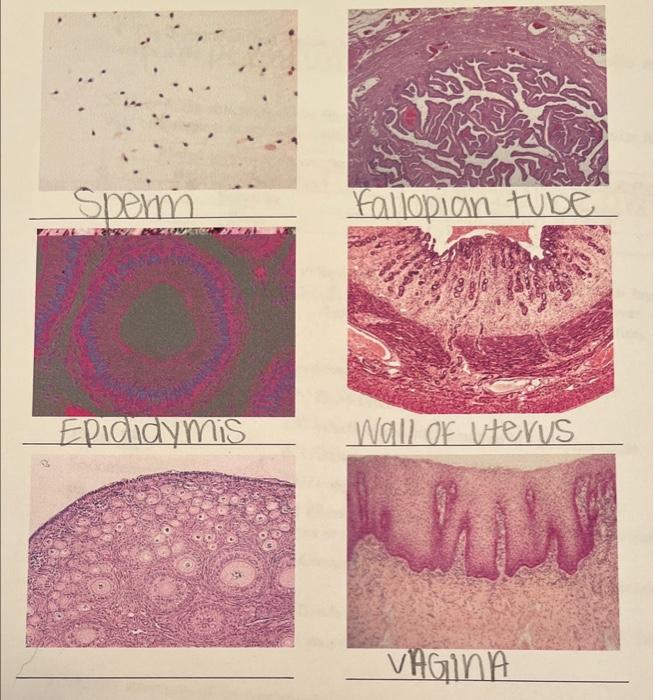 Solved 8. Identify Structures Of The Reproductive | Chegg.com