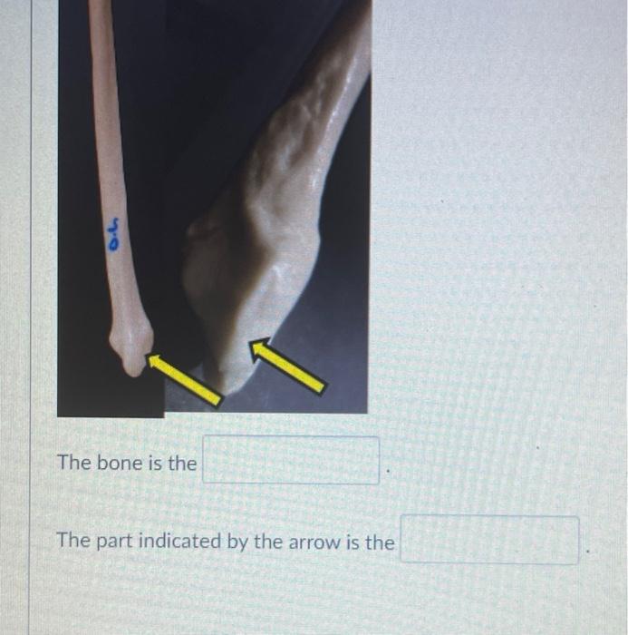 Solved 0.6 The bone is the The part indicated by the arrow | Chegg.com