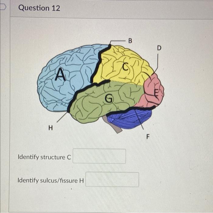 Solved D Question 11 D A A 00 B C Identify the structure | Chegg.com