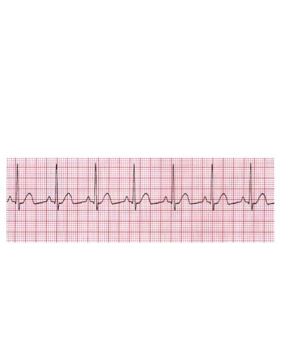 Solved EKG Lab Assignment NAME: 1. Use the 5 cardinal rules | Chegg.com