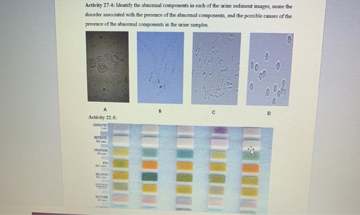 Activity 27-4: Identify the abnormal components in | Chegg.com