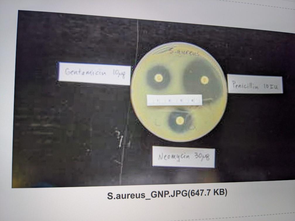 Disk Diffusion Results Diameter of Zone of Inhibition | Chegg.com