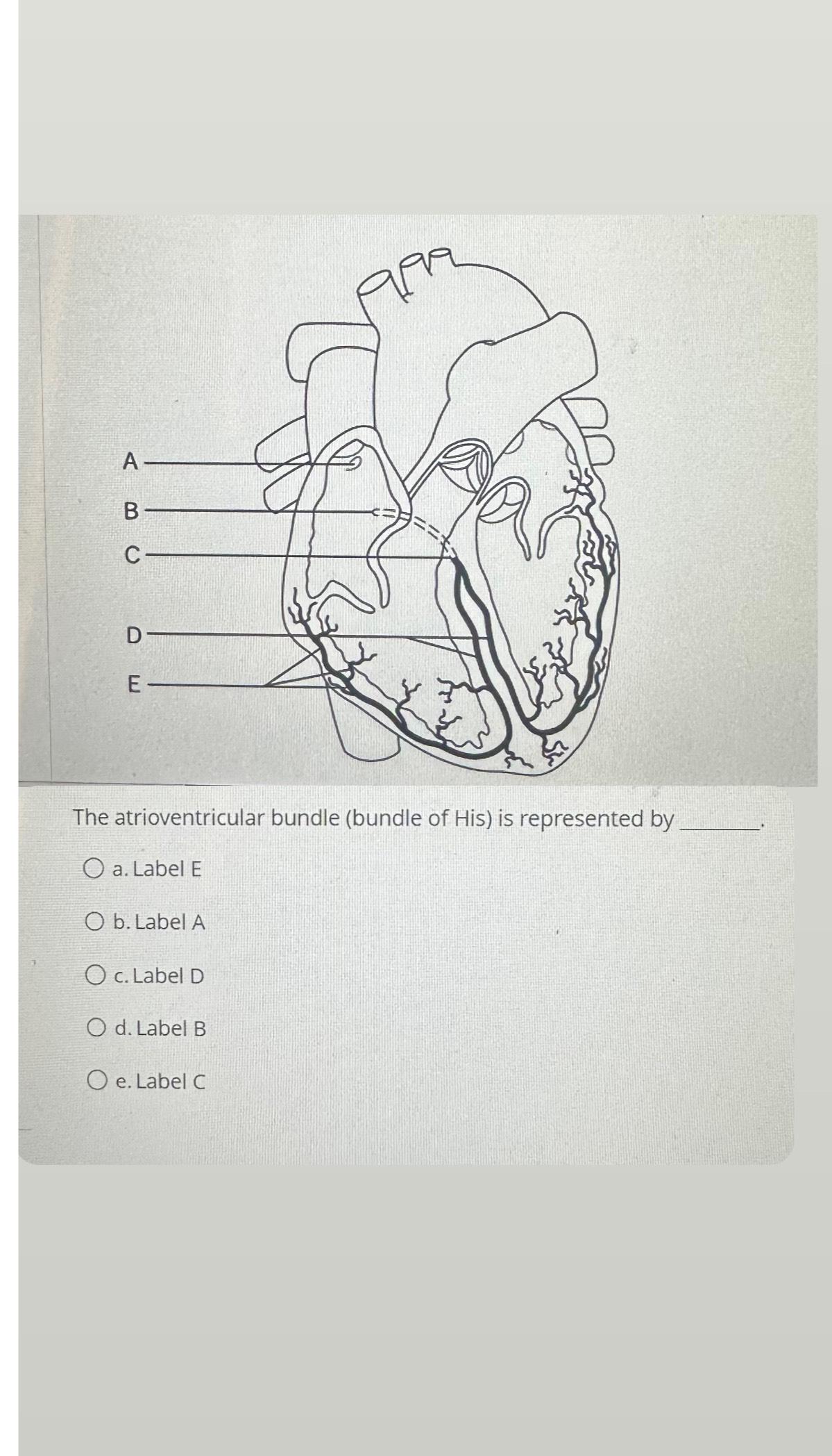 Solved The atrioventricular bundle (bundle of His) ﻿is | Chegg.com